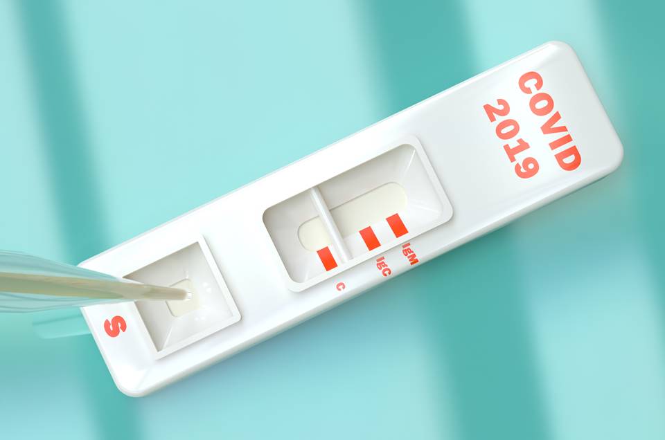 Covid-19: Anvisa deverá aprovar testes rápidos em farmácia em todo o País