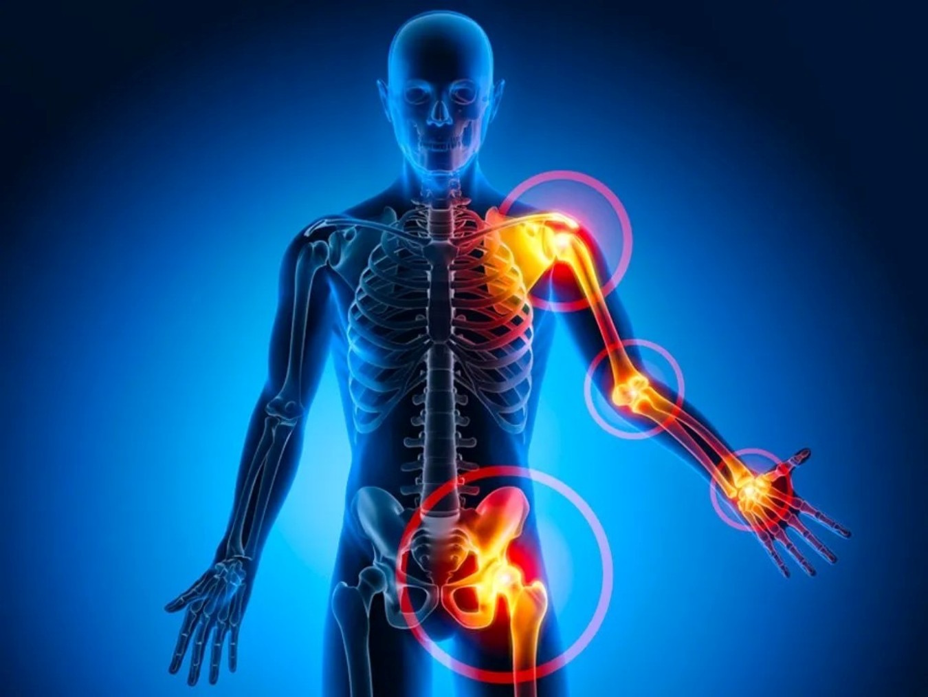 Estudo de Stanford aponta regeneração de cartilagem e pode mudar tratamento da osteoartrite