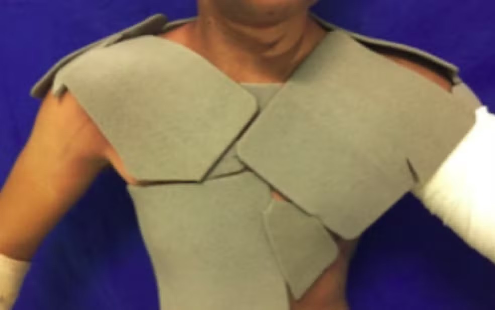 Estudo mostra que curativo mais caro pode tornar tratamento de queimaduras mais eficiente e econômico