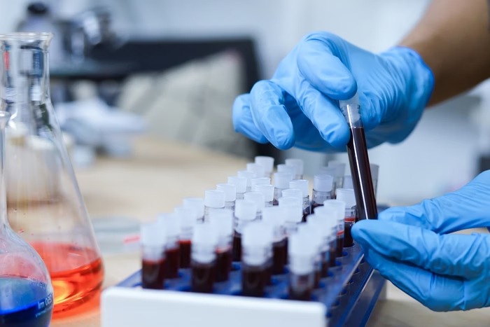 FDA aprova primeiro teste sanguíneo para diagnóstico precoce do Alzheimer