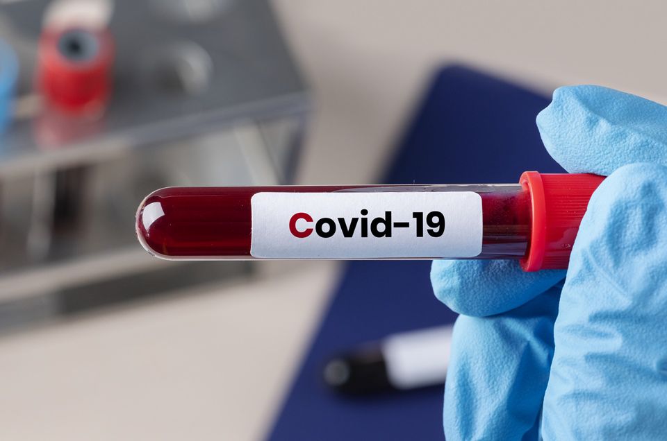 Farmacêuticos criam teste inédito que detecta três anticorpos do coronavírus