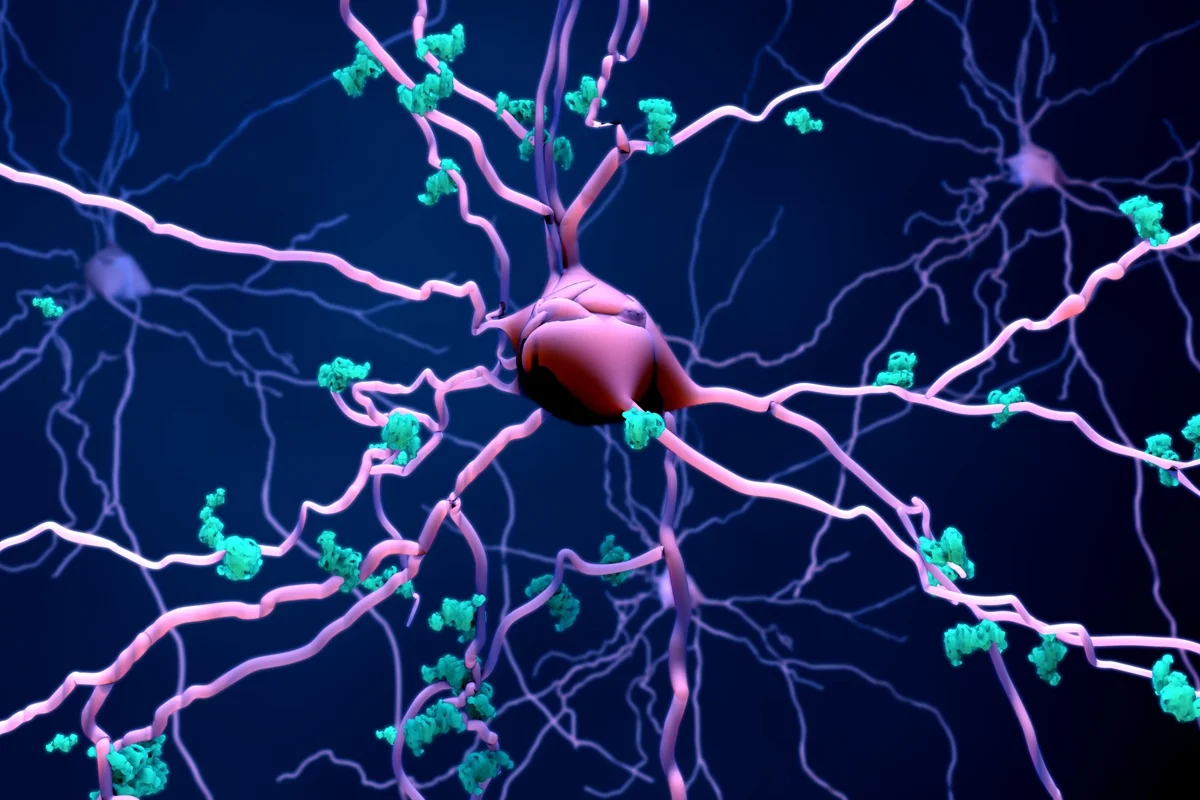 Medicamento antigo mostra efeito promissor contra morte de neurônios no Alzheimer