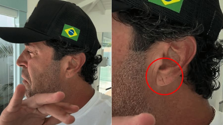 Morte de Maderite coloca sinal de Frank como alerta na prática do farmacêutico clínico