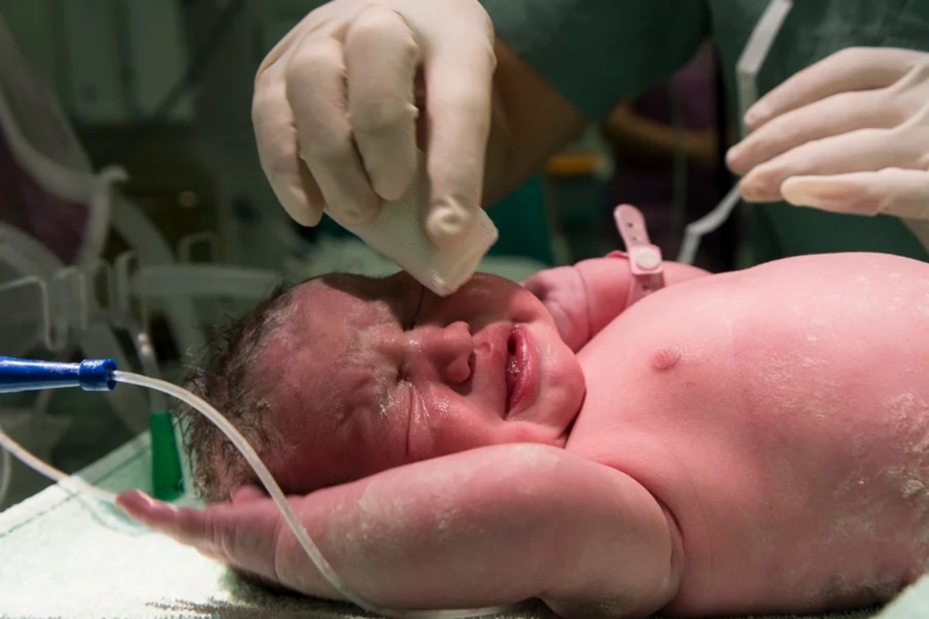 Mudanças em UTI neonatal reduzem infecções graves em prematuros