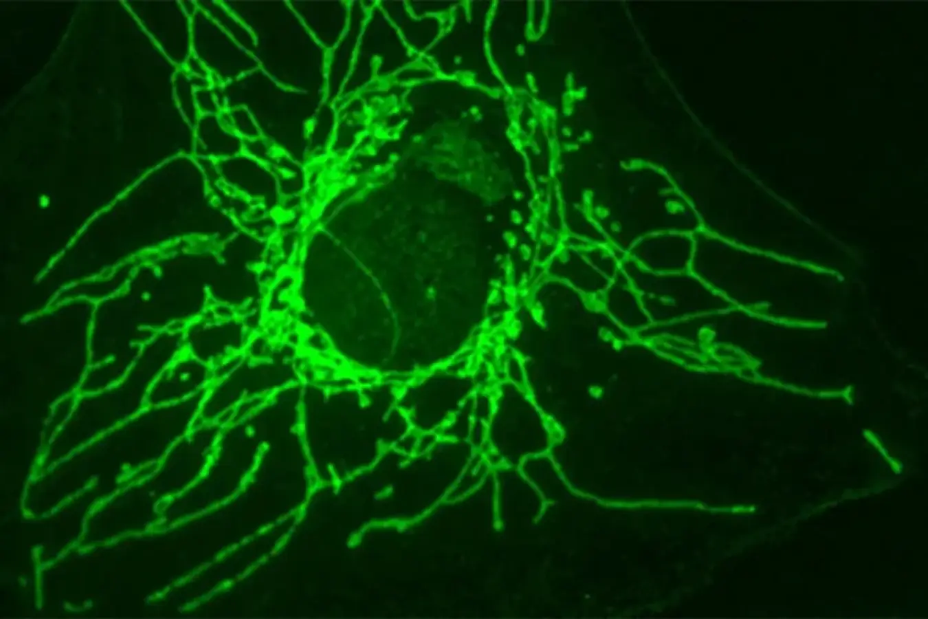 Nova molécula age contra o câncer sem afetar células normais Autor metrópoles