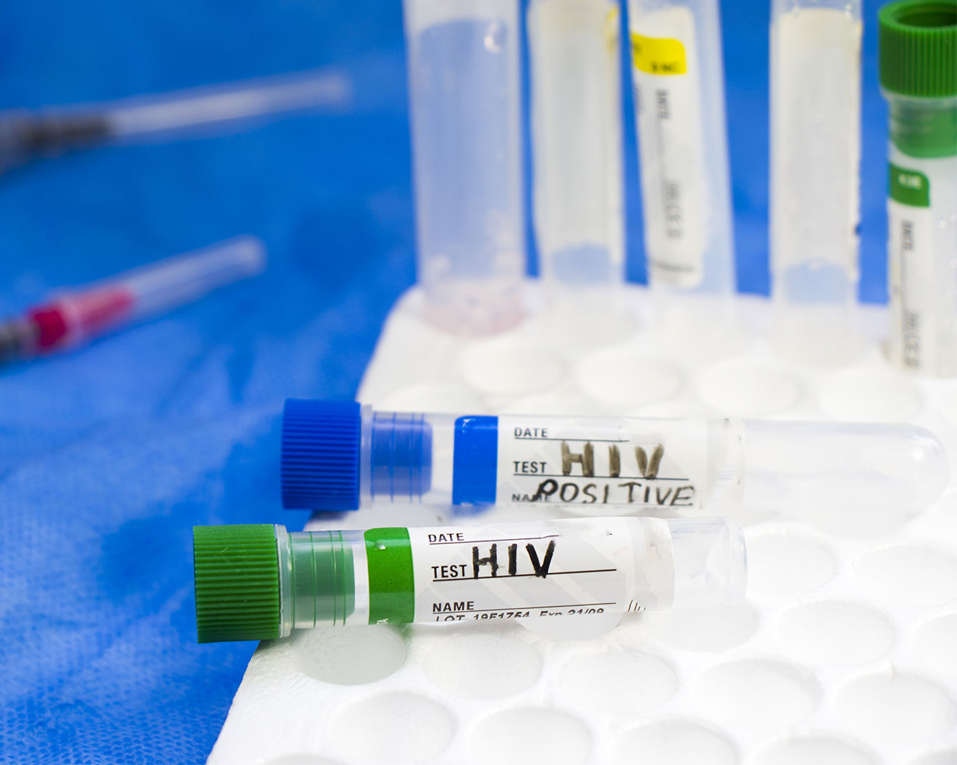 Pesquisadores descobrem nova variante do HIV combinando subtipos predominantes no Brasil