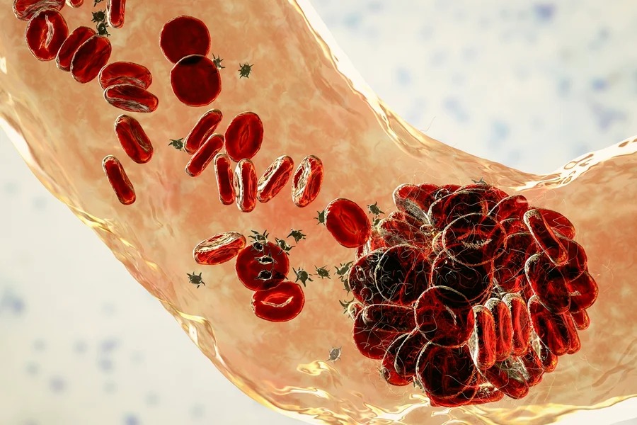 Teste feito em casa com sangue menstrual pode ampliar a prevenção do HPV