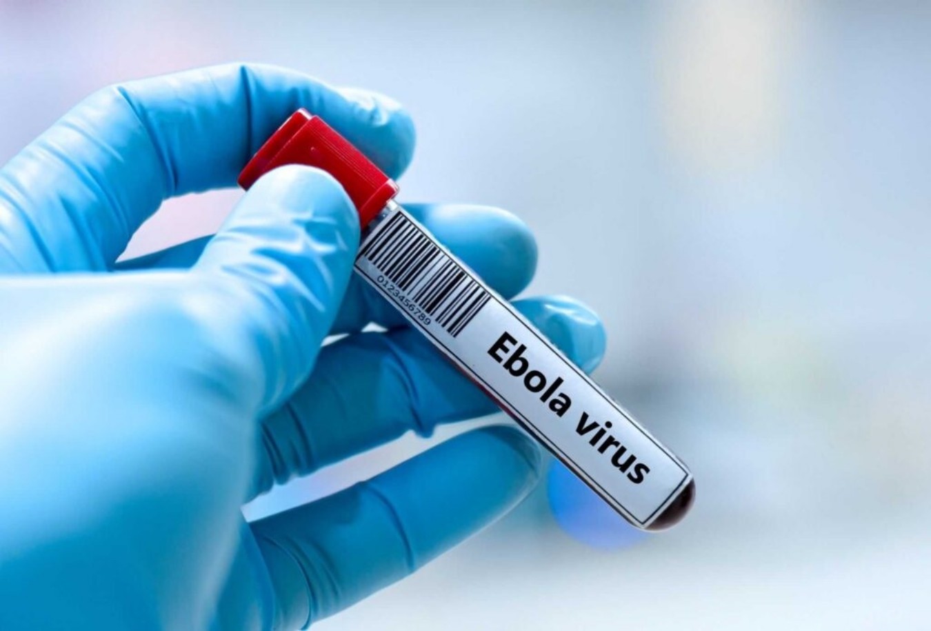Vacina de Oxford contra Ebola Bundibugyo pode avançar para testes em humanos