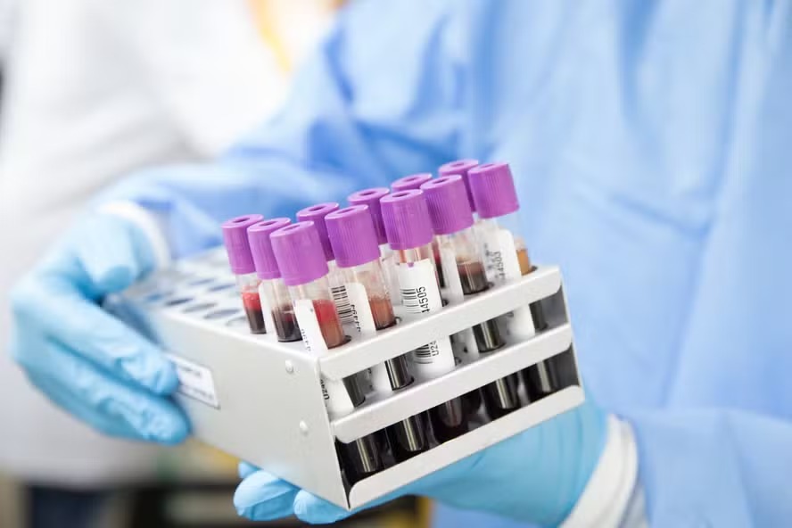 Vírus da hepatite D recebe mesma classificação cancerígena do HPV pela OMS
