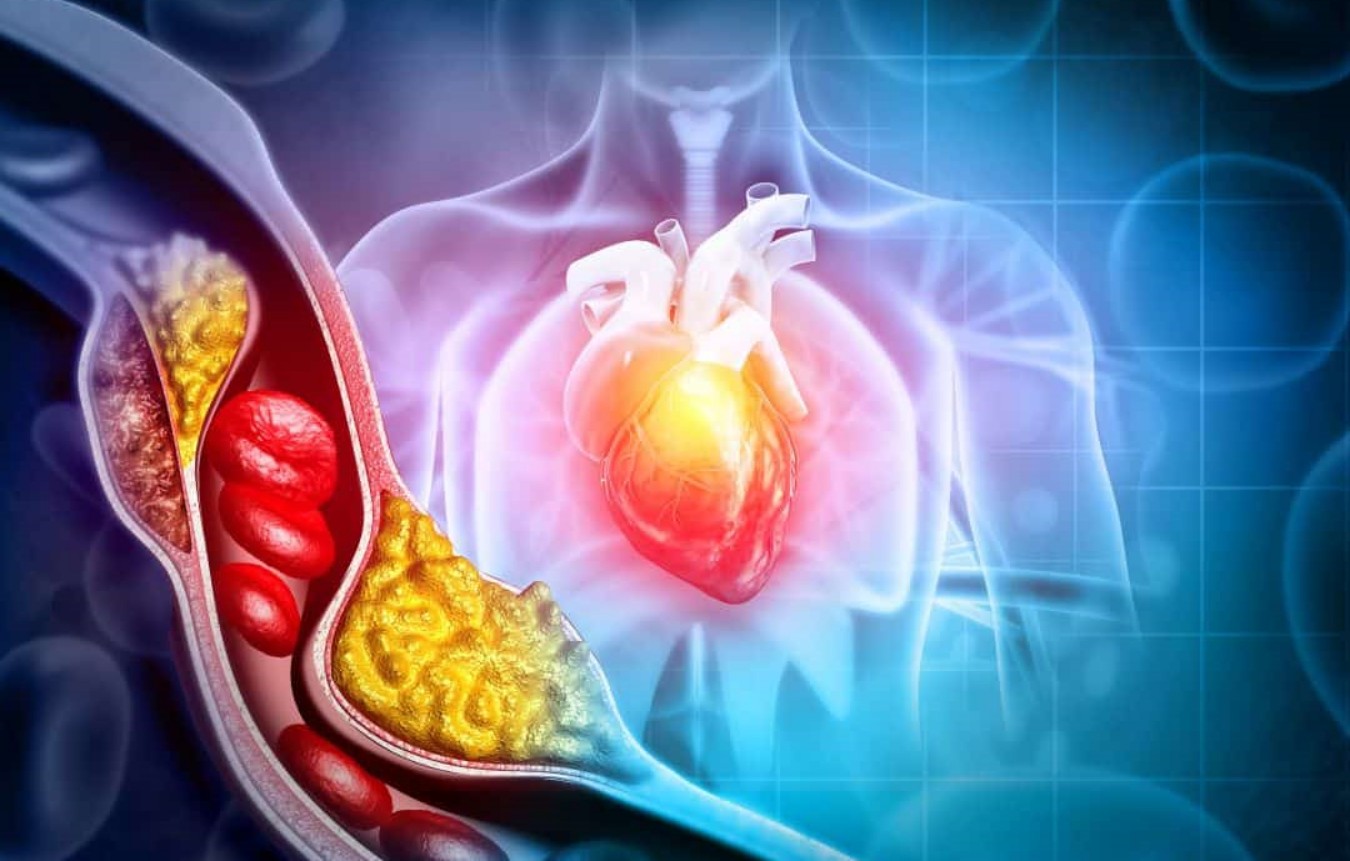Terapia de edição genética reduz LDL em estudo inicial e abre nova frente contra colesterol alto