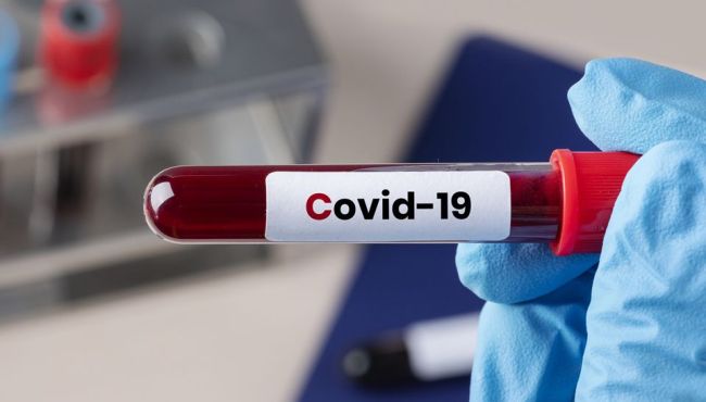 Farmacêuticos criam teste inédito que detecta três anticorpos do coronavírus