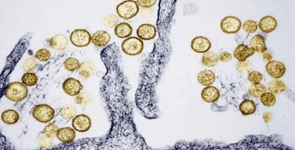 Paraná confirma casos de hantavírus e reforça alerta para prevenção e orientação em saúde