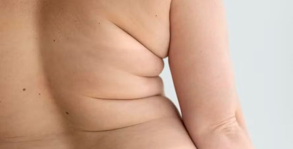 Estudo revela que melatonina pode proteger contra obesidade ao regular gordura visceral