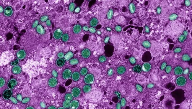 Nova cepa do vírus da mpox recombinante preocupa OMS e testes mostram que antiviral mais usado não é eficaz