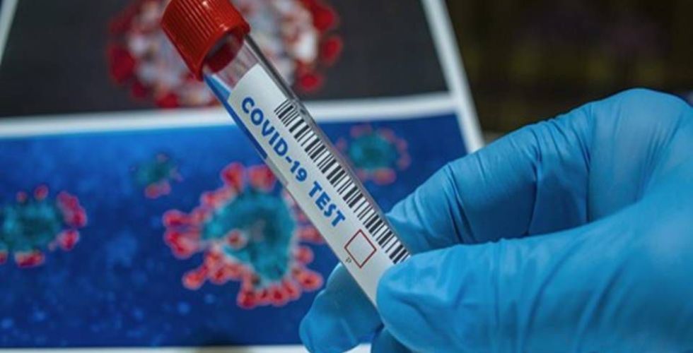 Covid-19: BioNTech compra laboratório da Novartis para ampliar produção de vacina