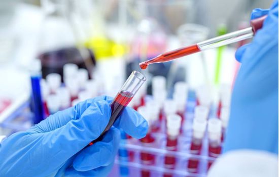 Rússia disponibiliza novo medicamento para tratamento da Covid-19