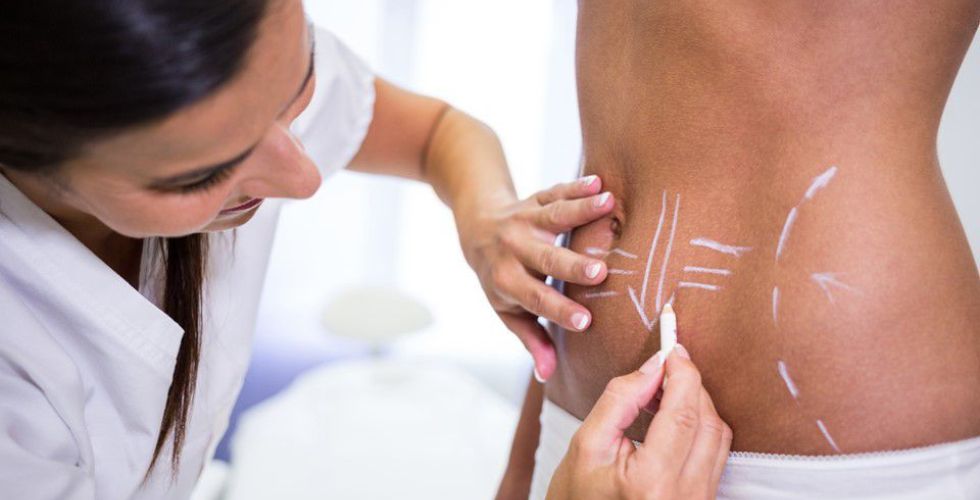 Atuação do farmacêutico esteta no tratamento da gordura localizada