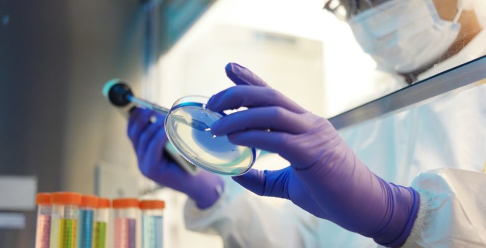Validação de métodos analíticos microbiológicos