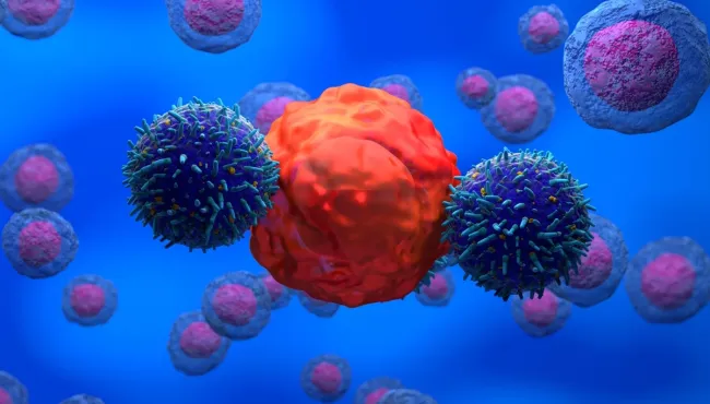 CAR-T brasileiro marca avanço histórico na oncologia ao alcançar remissão total em 72% dos pacientes