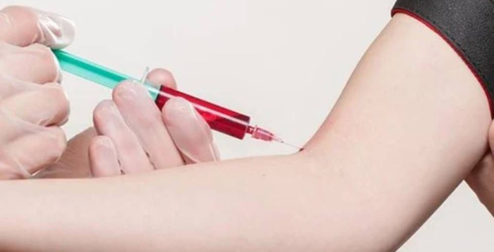 Roche lança teste capaz de identificar 324 genes relacionados ao câncer