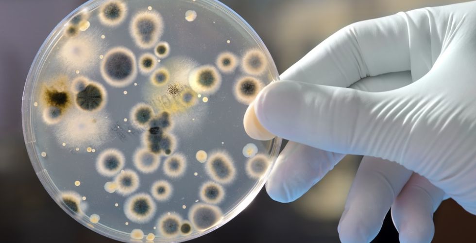 Superbactérias versus novos antibióticos: quem vai vencer essa guerra?