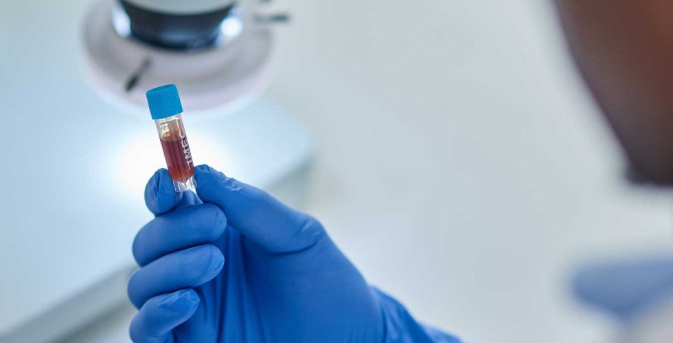 OMS declara mpox como emergência global de saúde pública