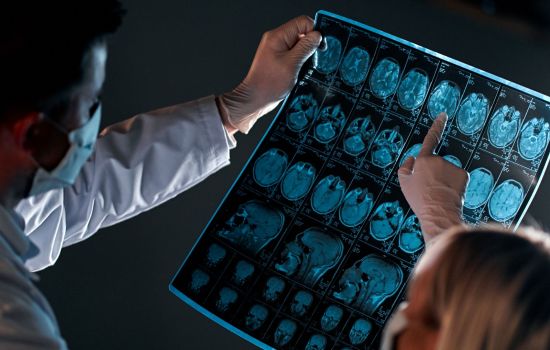Terapia CAR-T não aumenta risco de novos tumores, aponta pesquisa internacional