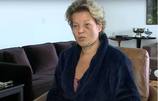 Caso Joice Hasselmann: reação adversa ao Stilnox  pode ter causado perda de memória