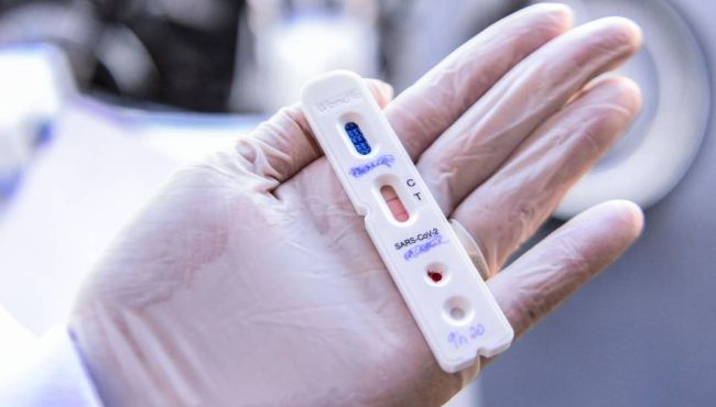 Alerta para a qualidade dos testes rápidos do coronavírus