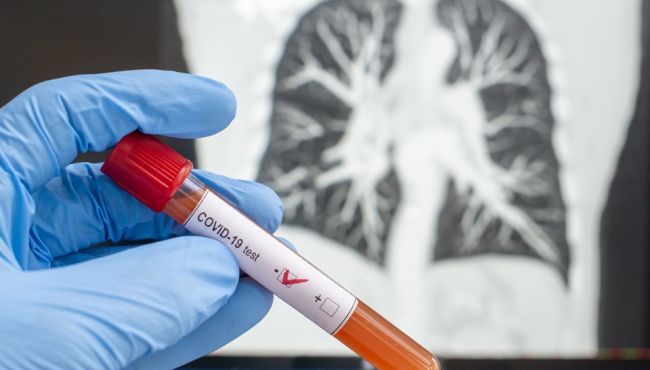 Saiba como as Análises Clínicas impactam o combate à pandemia