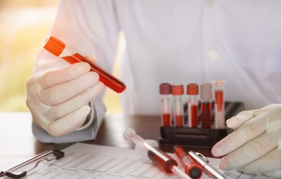A CARREIRA DO FARMACÊUTICO HEMATOLOGISTA