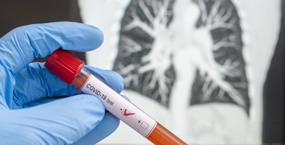 Saiba como as Análises Clínicas impactam o combate à pandemia