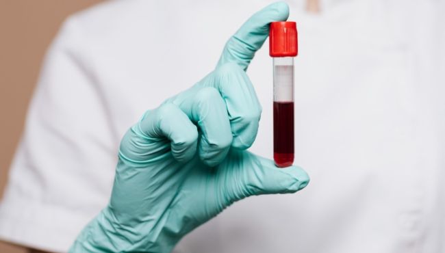 AGU confirma decisão da Anvisa de proibir a realização de testes laboratoriais remotos em farmácias