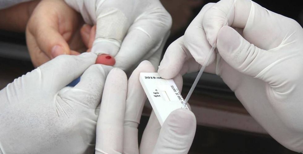 Covid-19: farmácia na UFRN realiza testes rápidos por R$ 250