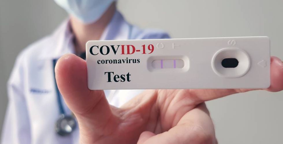 Covid-19: cresce realização de testes em farmácias, mas cientistas questionam eficácia