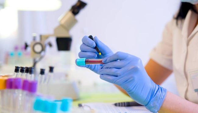 Roche e Hapvida investem R$ 46 milhões em polo de medicina diagnóstica