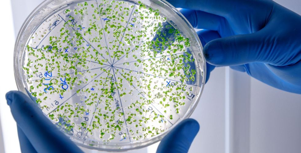Superbactéria entre as mais perigosas do mundo expõe risco e desafio clínico em UTI neonatal