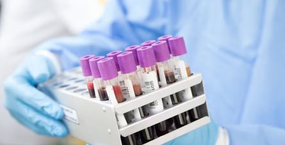 Vírus da hepatite D recebe mesma classificação cancerígena do HPV pela OMS