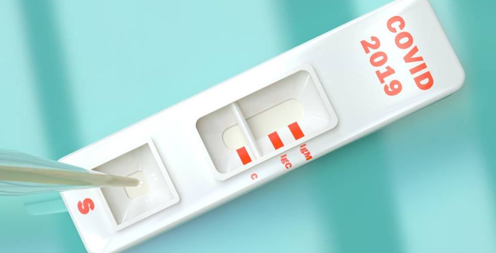 Covid-19: Anvisa deverá aprovar testes rápidos em farmácia em todo o País