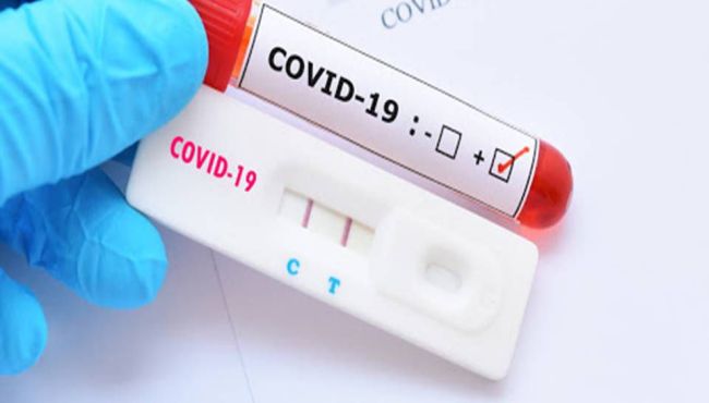 Farmácias devem informar sobre casos suspeitos de Covid-19 no Ceará