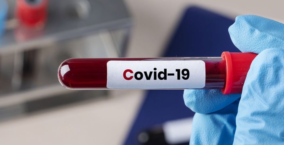 Inédito: mulher fica 152 dias com Covid-19 sem apresentar sintomas no Brasil