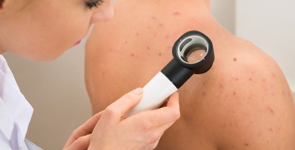 Protocolo de tratamento do câncer de pele