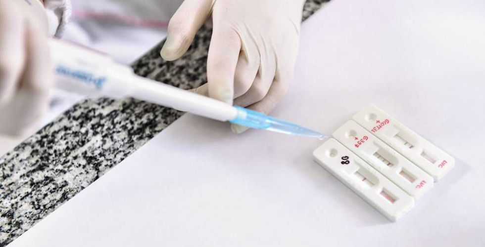 Fiocruz vai produzir 2,4 milhões de testes para diagnosticar coronavírus