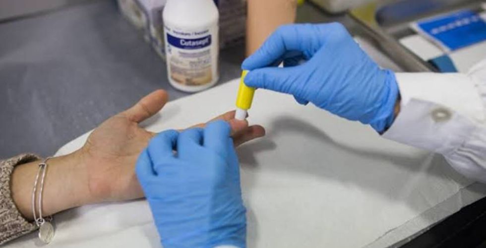 Vigilância Sanitária estabelece novas regras para testes rápidos em farmácias