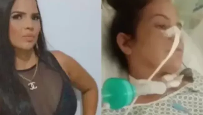 Mulher que usou caneta emagrecedora é diagnosticada com Guillain-Barré