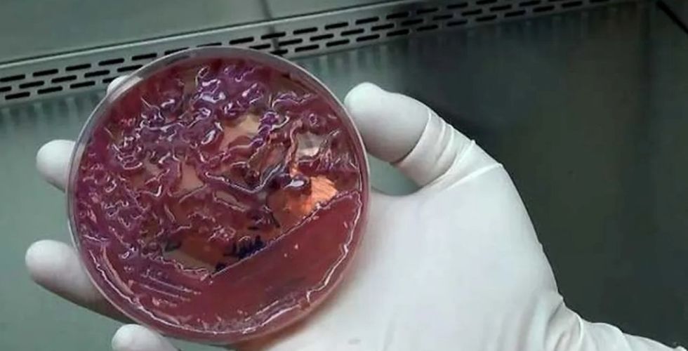 Superbactéria é identificada em 7 pacientes e leva ao fechamento de UTI