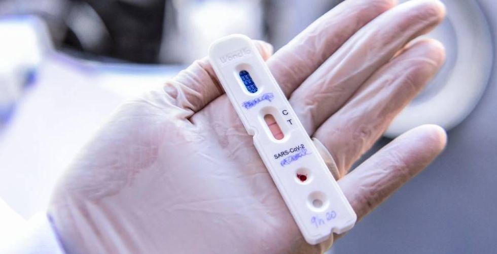 MP cobra medidas sanitárias de farmácias para testes de Covid-19