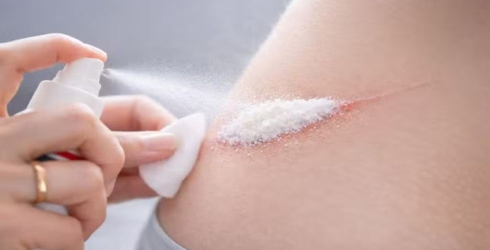 Pesquisadores criam spray capaz de estancar hemorragias em segundos