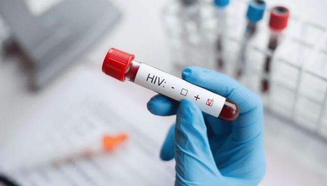 Cura do HIV pode estar em medicamento usado contra o câncer