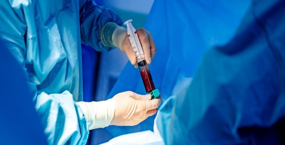 O que faz um farmacêutico no transplante de medula óssea